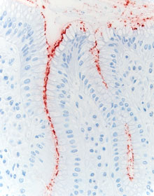 The antrum of the stomach of a patient infected with Helicobacter pylori and stained with polyclonal antibody to Helicobacter pylori
(Unauthorised copying of this image is prohibited)